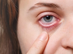 That Blood Spot In Your Eye: Risk Factors, Causes And Prevention