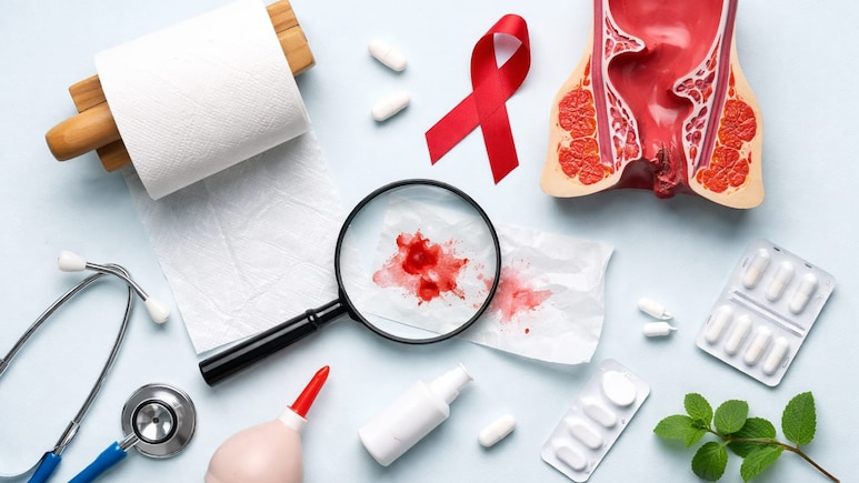 Anal Cancer Symptoms: टॉयलेट में खून दिखे तो सिर्फ पाइल्स समझकर न करें नजरअंदाज, हो सकता है गंभीर बीमारी का संकेत
