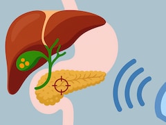 प‍ित्त की पथरी को बि‍ना ऑपरेशन के कैसे न‍िकालने का तरीका है ESWL, क्‍या है ये प्रक्रिया ज‍िसमें बि‍ना पेट काटे निकल जाती है पथरी?