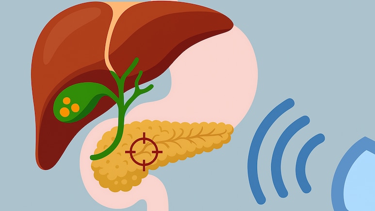 प&zwj;ित्त की पथरी को बि&zwj;ना ऑपरेशन के कैसे न&zwj;िकालने का तरीका है ESWL, क्&zwj;या है ये प्रक्रिया ज&zwj;िसमें बि&zwj;ना पेट काटे निकल जाती है पथरी