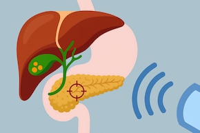 प&zwj;ित्त की पथरी को बि&zwj;ना ऑपरेशन के न&zwj;िकालने का तरीका है ESWL, क्&zwj;या है ये प्रक्रिया ज&zwj;िसमें बि&zwj;ना पेट काटे निकल जाती है पथरी?