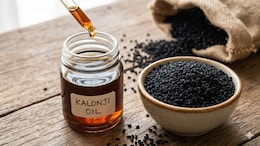 "Kalonji Is One Of The Nature's Strongest Remedies," Cardiologist Shares Ways To Use