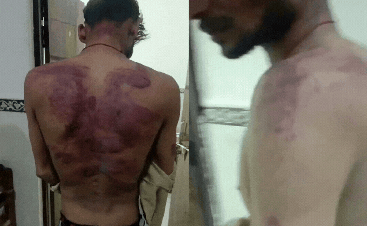 VIDEO: लड़ाई में बीच-बचाव करने की सजा, एक घंटे तक बेल्ट, लात-घूंसे बरसाए, नीली पड़ गई पूरी पीठ&nbsp;