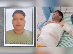 शादी का दबाव या कुछ और... आगरा में आखिर क्यों गर्लफ्रेंड ने ही बॉयफ्रेंड को जला दिया जिंदा