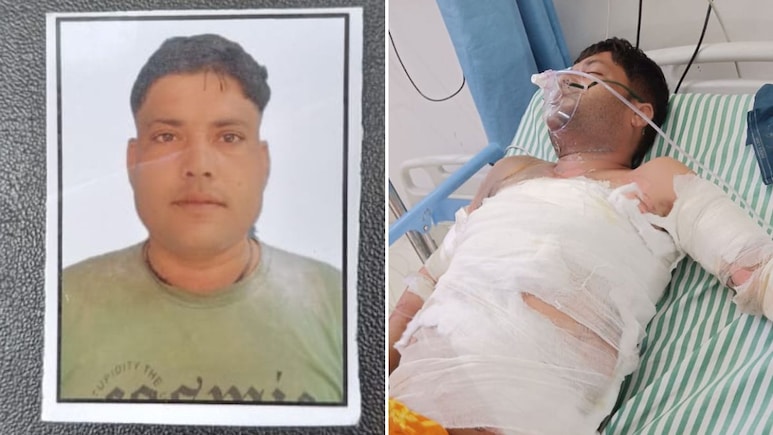 शादी का दबाव या कुछ और... आगरा में आखिर क्यों गर्लफ्रेंड ने ही बॉयफ्रेंड को जला दिया जिंदा