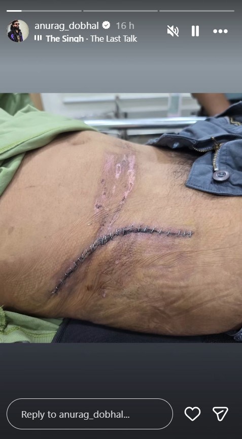 Instagram/Anurag Dobhal