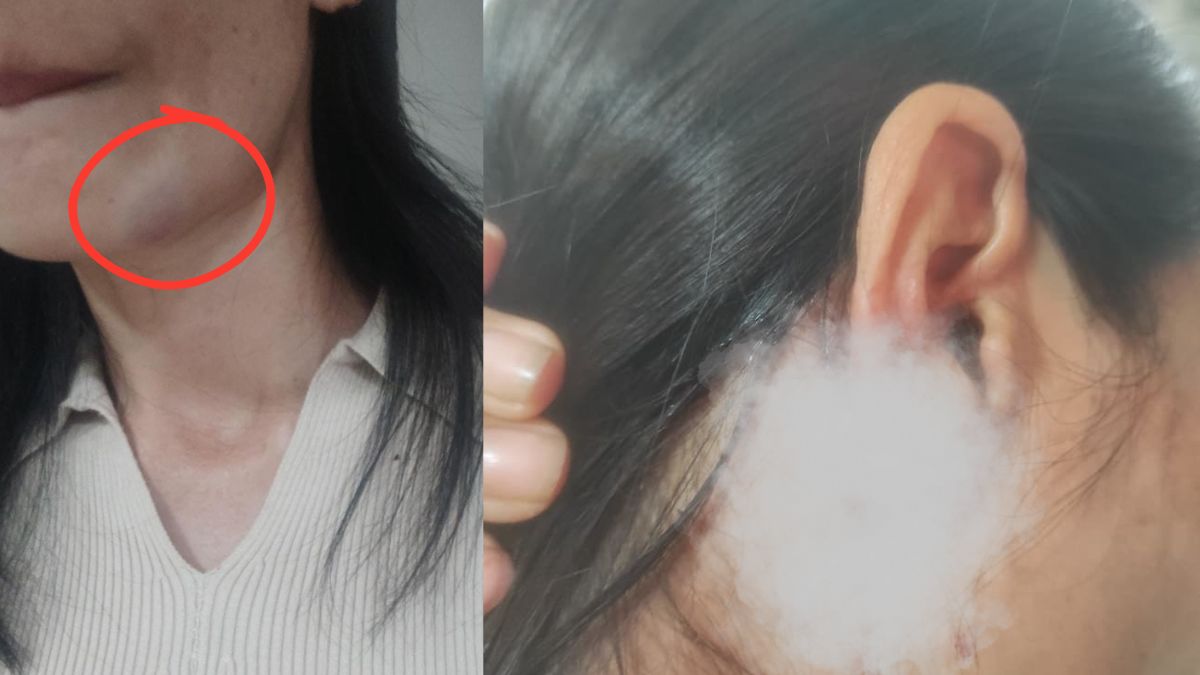 गंदे कमेंट का किया विरोध, दिल्ली में मणिपुर की लड़की पर हो गया हमला, गले-कान पर वार