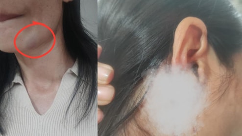 गंदे कमेंट का किया विरोध, दिल्ली में मणिपुर की लड़की पर हो गया हमला, गले-कान पर वार