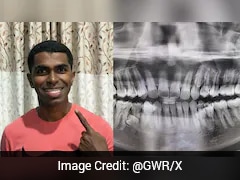 Malaysian Man With 42 Teeth Sets World Record For Most Teeth In Mouth