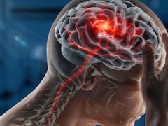 मिडिल एज में छोटी-छोटी बातें भूलना पड़ सकता है भारी, कहीं ये Alzheimer’s Disease के शुरुआती संकेत तो नहीं?