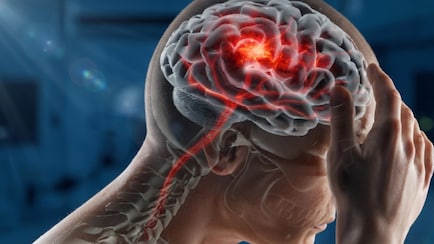 मिडिल एज में छोटी-छोटी बातें भूलना पड़ सकता है भारी, कहीं ये Alzheimer's Disease के शुरुआती संकेत तो नहीं?