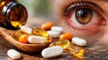 Vitamin B3 Side Effects: बिना डॉक्टर की सलाह के विटामिन B3 लेना पड़ सकता है भारी, आंखों की रोशनी तक जा सकती है