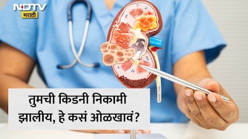 Kidney Failure: तुमची किडनी नीट काम करत नाहीय, हे तुम्हाला कसं कळेल? किडनी खराब होण्याची सुरुवातीची लक्षण काय आहेत?