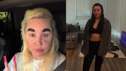 Amanda Bynes Opens Up About Her Weight Loss Journey: "Lost 12.7 Kg On Ozempic"