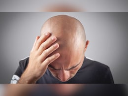 Male Pattern Baldness Caused By Gut Health? New Study Finds Surprising Link