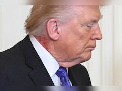 Trump Appears With Red Rash On Neck, Officials Say Caused By Skin Cream