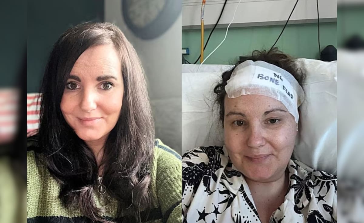 डॉक्टर कहते रहे मामूली 'तनाव' है...पर दिमाग में पल रहा था 'दुश्मन', अब हेलमेट है जिंदगी का सहारा