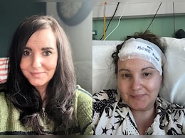 डॉक्टर कहते रहे मामूली 'तनाव' है...पर दिमाग में पल रहा था 'दुश्मन', अब हेलमेट है जिंदगी का सहारा