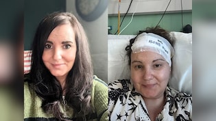 डॉक्टर कहते रहे मामूली 'तनाव' है...पर दिमाग में पल रहा था 'दुश्मन', अब हेलमेट है जिंदगी का सहारा