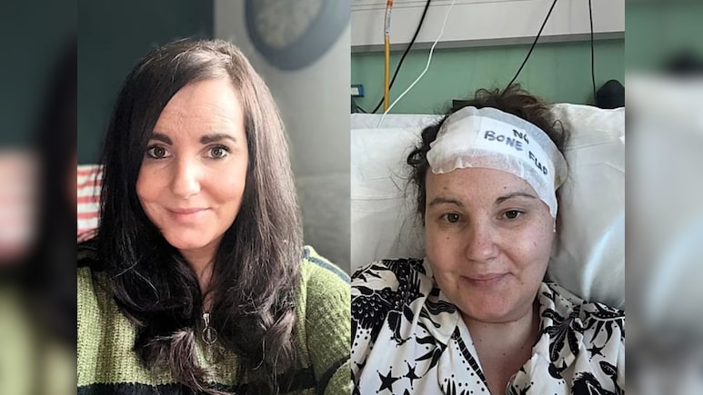 डॉक्टर कहते रहे मामूली 'तनाव' है...पर दिमाग में पल रहा था 'दुश्मन', अब हेलमेट है जिंदगी का सहारा