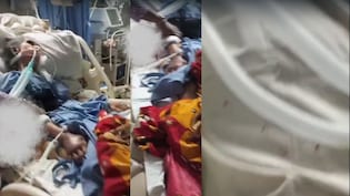 घोर लापरवाही! महाराष्ट्र में ICU में भर्ती बुजर्ग महिला के शरीर को चूहों ने कुतरा, डॉक्टर-नर्स भी नहीं जान पाए