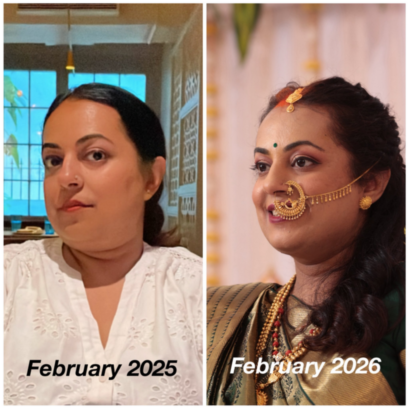 'When I Started..': Woman Loses 30 Kg Using Ozempic, Lists Side Effects Too