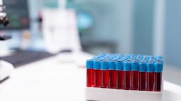 Are Haemoglobin And Ferritin The Same? An Expert Explains What Your Blood Tests Really Mean