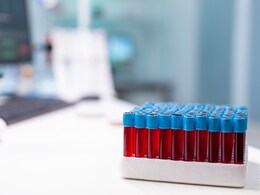 Are Haemoglobin And Ferritin The Same? An Expert Explains What Your Blood Tests Really Mean