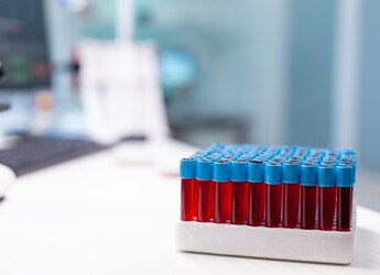 Are Haemoglobin And Ferritin The Same? An Expert Explains What Your Blood Tests Really Mean