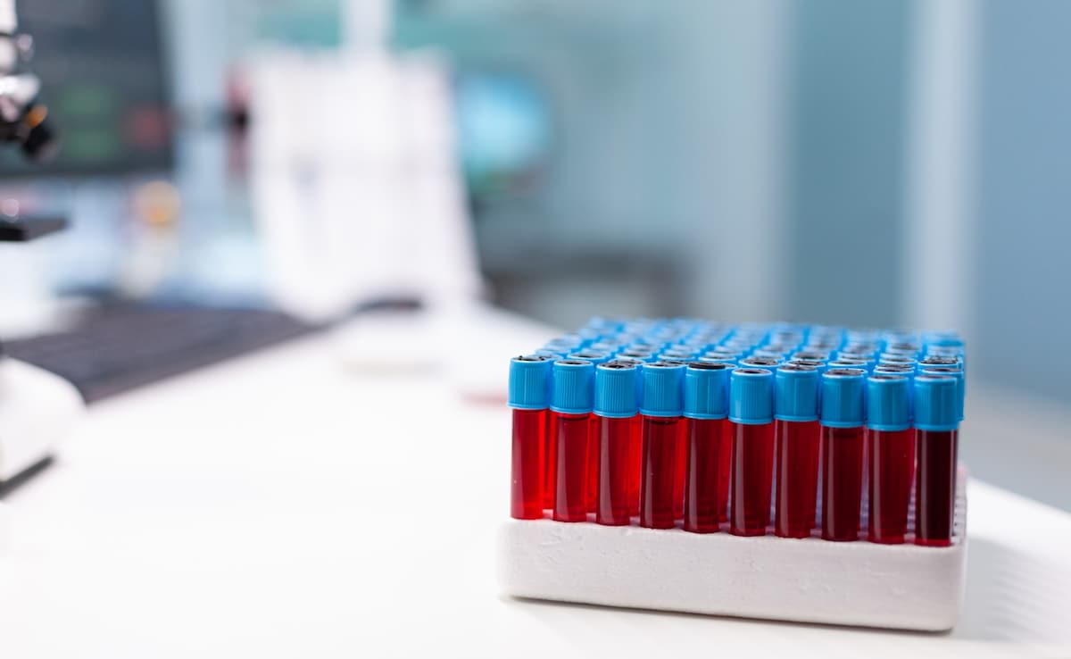 The Art of Baking: From Classic Bread to Artisan Pastries