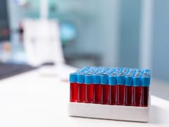 American Heart Association Releases Cholesterol Management Guidelines