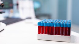 Rising CO2 Levels Are Reflected In Human Blood. Scientists Don't Know What It Means