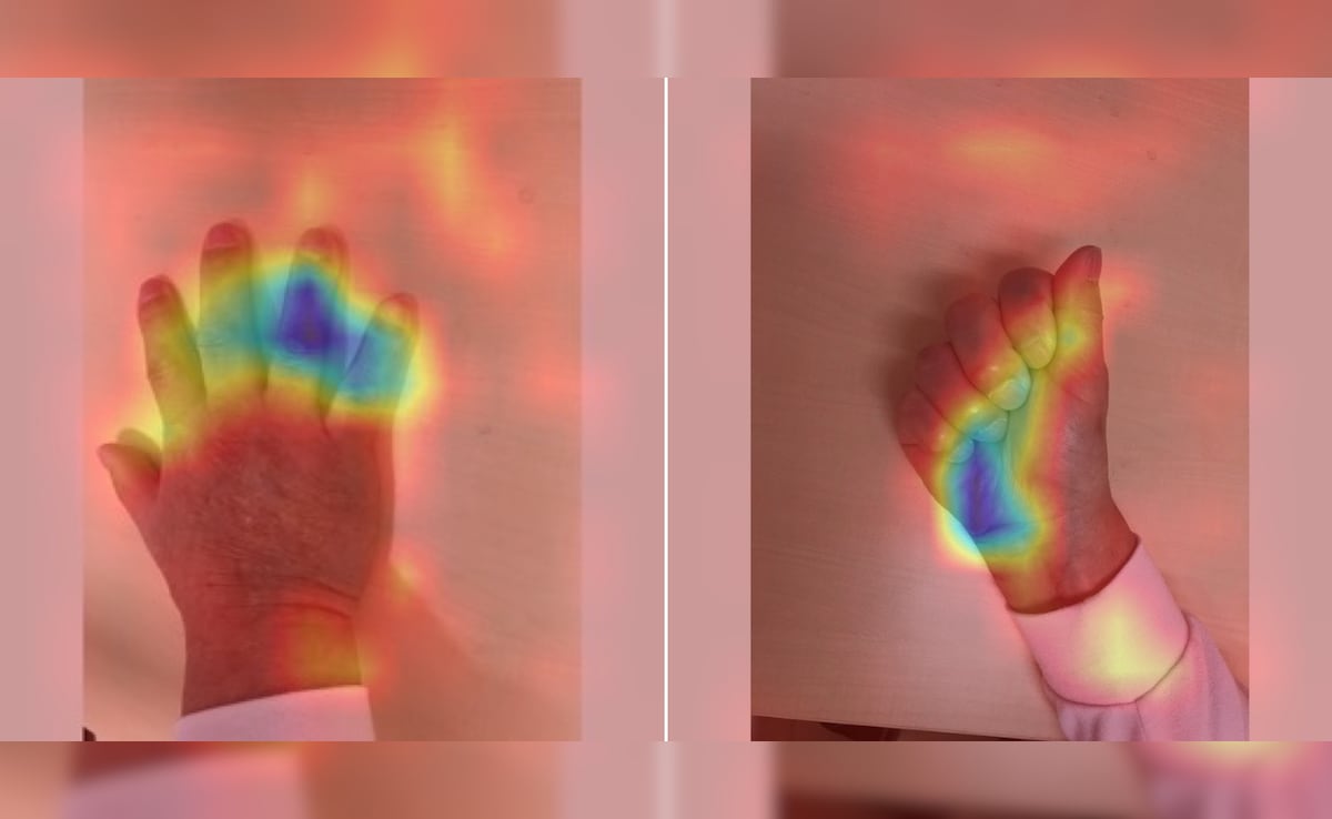 The Kobe University team used images only of the back of the hand and the clenched fist, avoiding the more individual palm line patterns. 