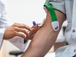 Union Health Ministry Proposes To Remove Duplicate Viral Testing Of Blood Products