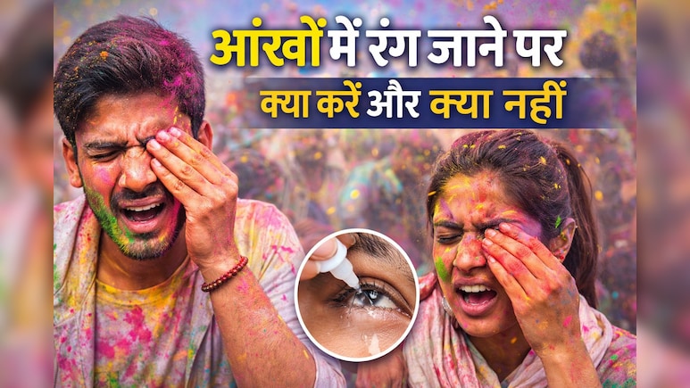 आंखों में रंग जाने पर क्या करें और क्या नहीं? होली में आई केयर के जरूरी टिप्स