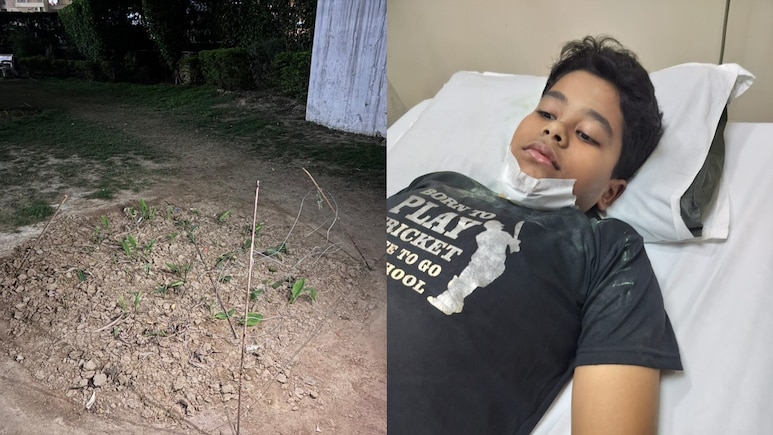 ग्रेटर नोएडा: अजनारा होम्स सोसाइटी में बड़ा हादसा, खेलते समय बच्चे के मुंह में घुसा सरिया