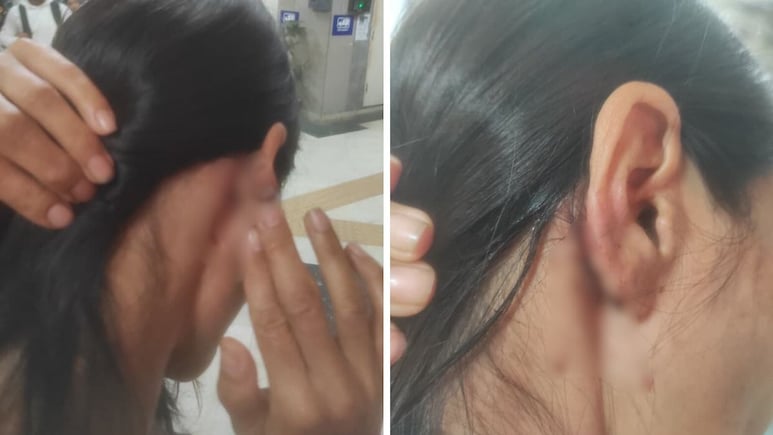 Manipur Woman Assaulted Near Delhi Court After Objecting To Harassment