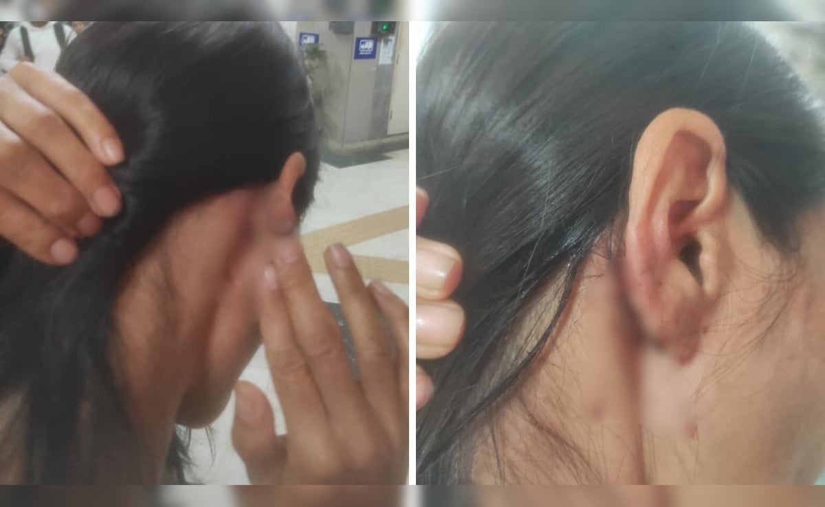 Manipur Woman Beaten With Belt After Objecting To Harrasment In Delhi Park