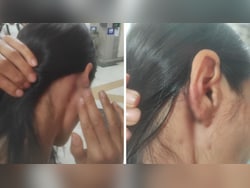 Manipur Woman Beaten With Belt After Objecting To Harrasment In Delhi Park