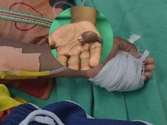 ये क्या कर दिया ! महाराष्ट्र के अस्पताल में मासूम की सर्जरी में चूक, डॉक्टर ने निकाल दी गलत हाथ की उंगली