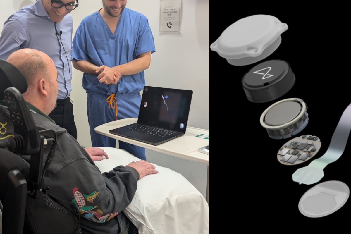 दिमाग से कंट्रोल हो रहा है लैपटॉप! Neuralink इम्प्लांट के बाद शख्स ने शेयर किया 100 दिनों का अनुभव