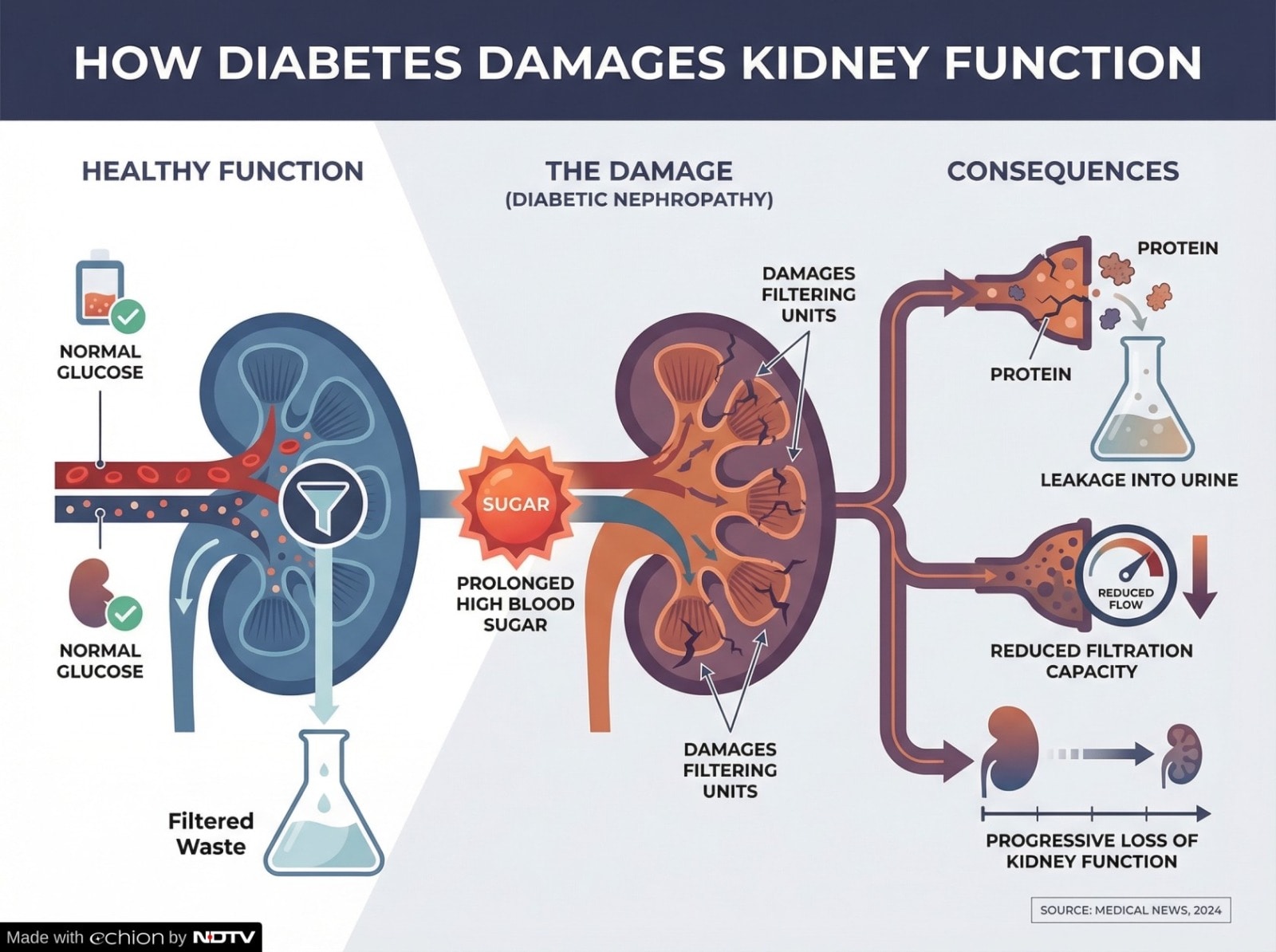 Latest and Breaking News on NDTV