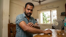 Warm, Moist And Itchy: 7 Fungal Infections You Must Protect Against In Summers
