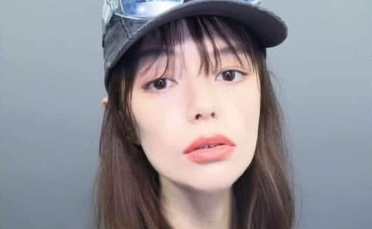 Nick Jonas' Friend Maya Kibbel Dies Of Wilson's Disease At 30: Signs And Risks Of The Rare Disease Explained