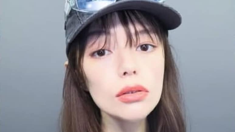 Nick Jonas' Friend Maya Kibbel Dies Of Wilson's Disease At 30: Signs And Risks Of The Rare Disease Explained