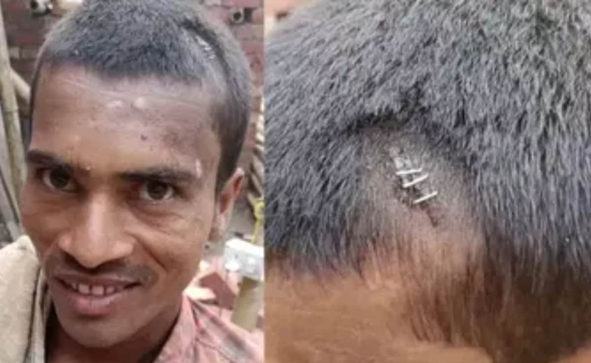बिहार के युवक का सिर फटने पर स्टेपलर पिन मारने के वायरल वीडियो की सच्चाई
