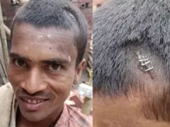 बिहार के युवक का सिर फटने पर स्टेपलर पिन मारने के वायरल वीडियो की सच्चाई