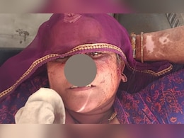 सांचौर में सनसनीखेज वारदात सास से नाराज दामाद ने कैंची से काट दी नाक, कटा हिस्सा लेकर हुआ फरार&nbsp;