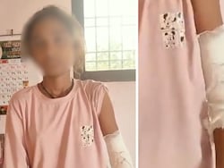 Class 5 Student Couldn't Solve Math Problem. Teacher Beats Her Brutally