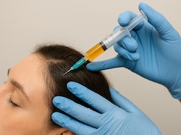 किम कार्दशियन से अनुष्का शर्मा तक, क्यों ट्रेंड कर रही है Platelet-Rich Plasma थेरेपी